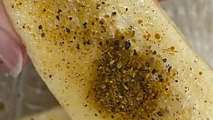 Os alimentos inflamatórios que podem agravar as dores da artrite